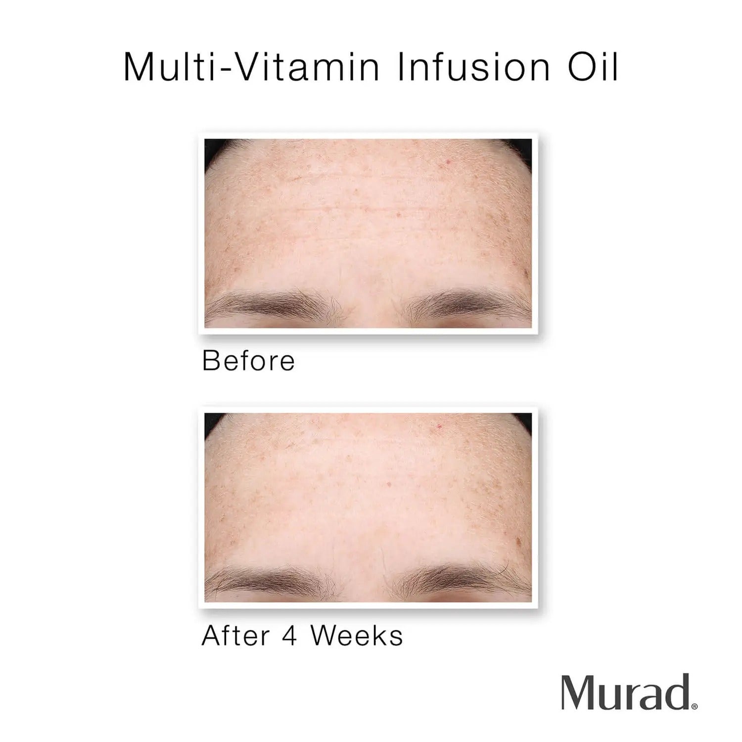 Murad Hydrate Trial Kit